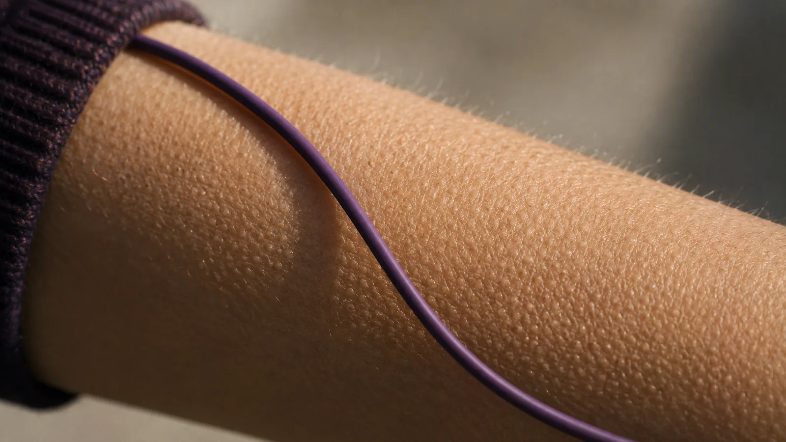 A close crop of a forearm with goosebumps and a headphone cable across it.